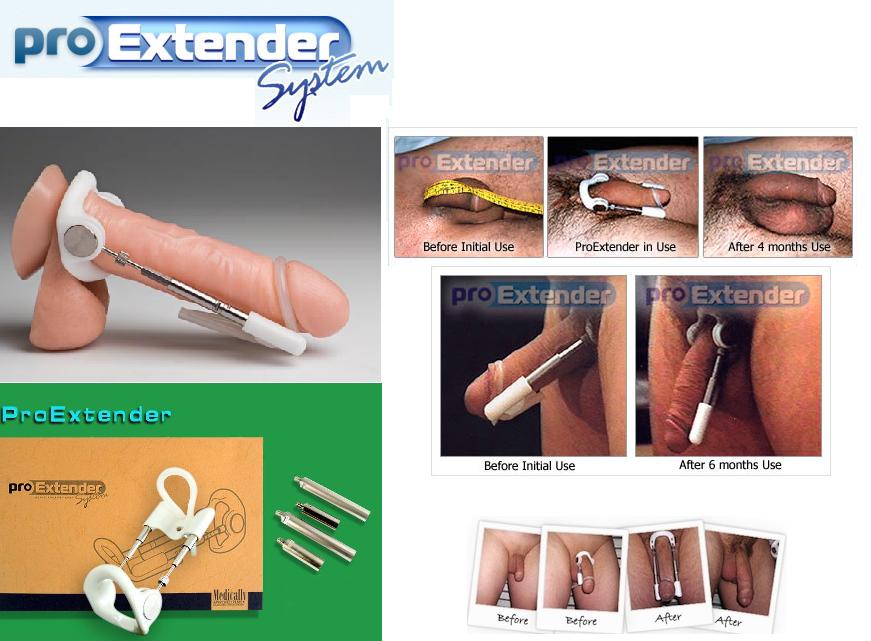 Gnetics Extender- forradalmian új pénisz nyújtó készülék - L